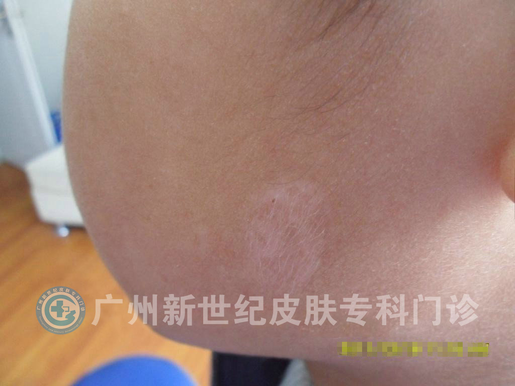 51-160H614530N18.jpg